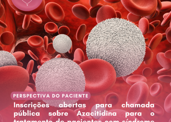 Síndrome mielodisplásica de alto risco: Azacitidina/Perspectiva do Paciente – Conitec