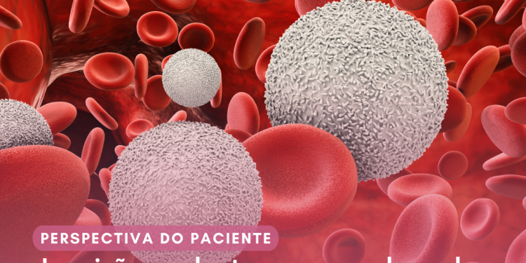 Síndrome mielodisplásica de alto risco: Azacitidina/Perspectiva do Paciente – Conitec