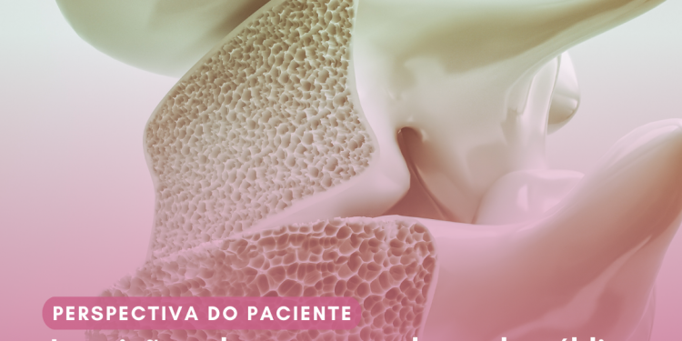 Osteoporose: Romosozumabe e teriparatida/Perspectiva do Paciente – Conitec