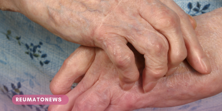 Comissão de Assuntos Sociais poderá votar o projeto que cria o Dia Nacional de Conscientização sobre as Doenças Reumáticas