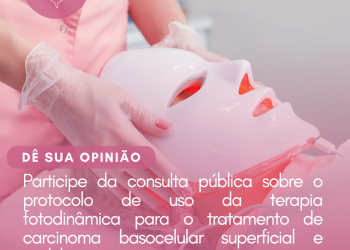 Carcinoma Basocelular Superficial e Nodular: Terapia Fotodinâmica/Consulta Pública – CONITEC
