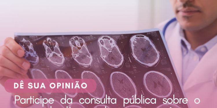 Esclerose Múltipla: Protocolo Clínico e Diretrizes Terapêuticas/Consulta Pública – CONITEC