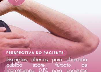 Dermatite atópica: Furoato de mometasona 0,1%/Perspectiva do Paciente – CONITEC