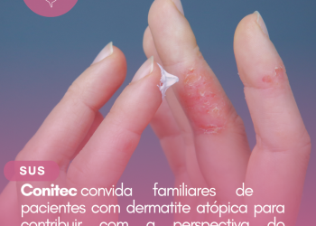 Conitec convida familiares de pacientes com dermatite atópica para contribuir com a perspectiva do paciente