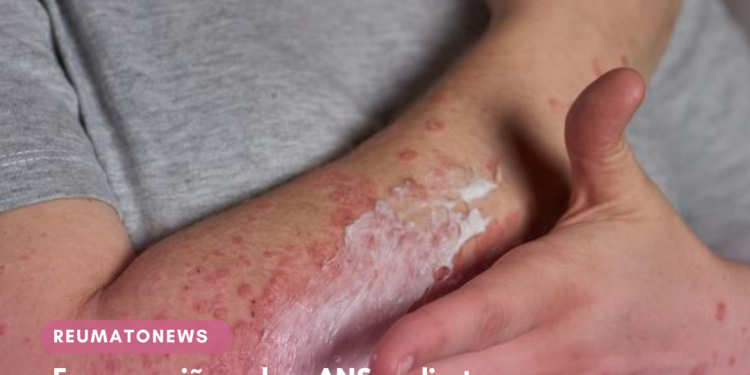 Em reunião da ANS, diretores aprovam tecnologias para dermatite atópica grave, neoplasia primária de próstata e câncer de pulmão de células não pequenas