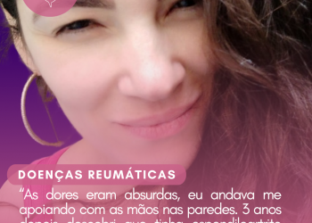 “As dores eram absurdas, eu andava me apoiando com as mãos nas paredes. 3 anos depois descobri que tinha espondiloartrite axial”