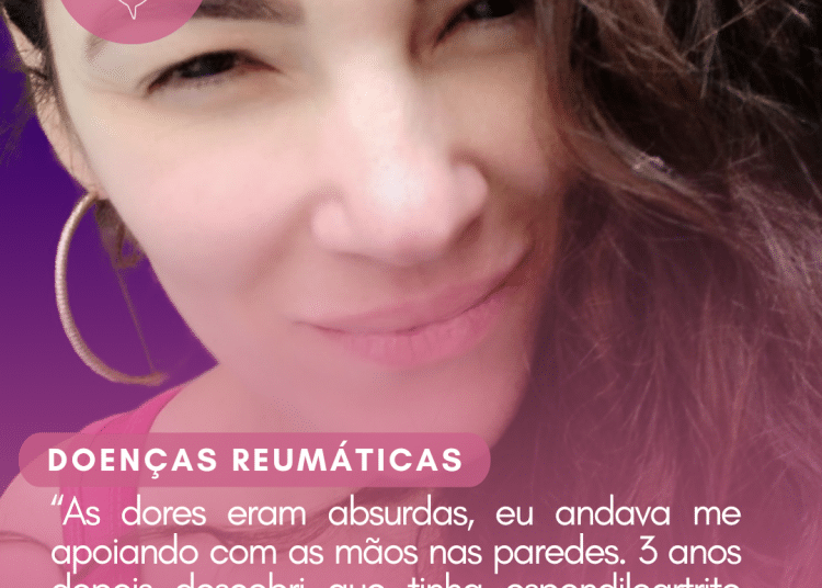 “As dores eram absurdas, eu andava me apoiando com as mãos nas paredes. Três anos depois descobri que tinha espondiloartrite axial”