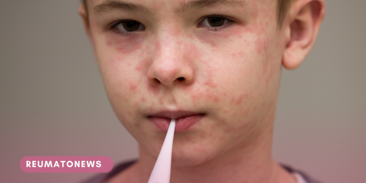 Sarampo, HPV e mais: vacinação cai nas Américas e não recupera níveis registrados antes da pandemia