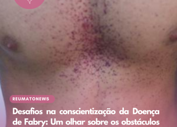 Desafios na conscientização da Doença de Fabry: Um olhar sobre os obstáculos enfrentados pelos pacientes