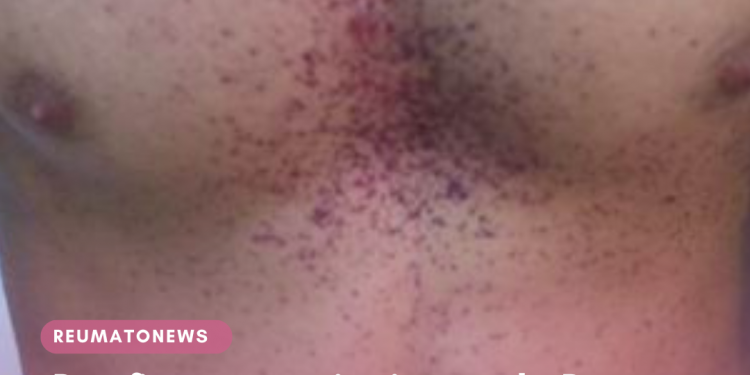 Desafios na conscientização da Doença de Fabry: Um olhar sobre os obstáculos enfrentados pelos pacientes