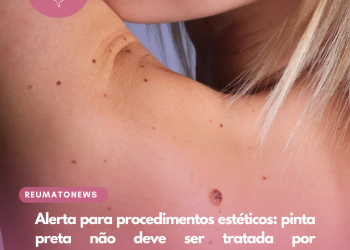 Alerta para procedimentos estéticos: pinta preta não deve ser tratada por profissionais não médicos