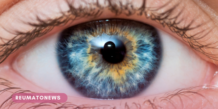 Quase 70% dos brasileiros com glaucoma desconhecem que estão com a doença