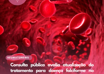 Consulta pública avalia atualização do tratamento para doença falciforme no SUS
