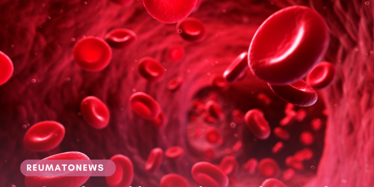 Consulta pública avalia atualização do tratamento para doença falciforme no SUS