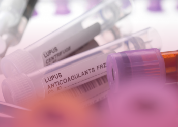 Lúpus: a importância da pesquisa clínica na busca de novos tratamentos para a doença