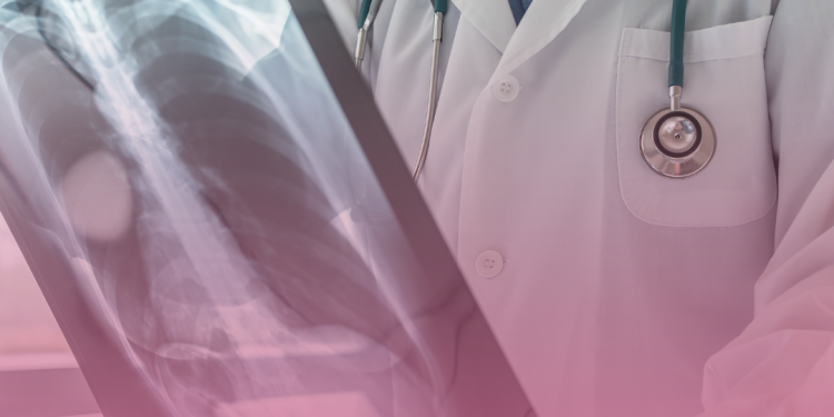 Anvisa aprova amivantamabe em combinação com quimioterapia para participantes da pesquisa com câncer de pulmão de células não pequenas com mutações EGFR tratados anteriormente