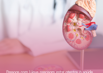 Pessoas com Lúpus precisam estar atentas à saúde dos rins