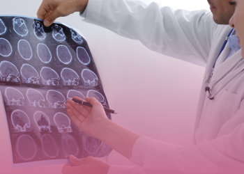 Esclerose Múltipla: mitos e verdades sobre a doença que atinge mais de 40 mil brasileiros