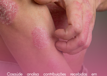 Cosaúde analisa contribuições recebidas em consultas públicas sobre nefrite lúpica, asma alergica grave, psoríase e leucemia