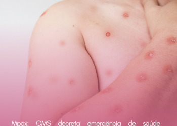 Mpox: OMS decreta emergência de saúde internacional pela doença; entenda o que isso significa