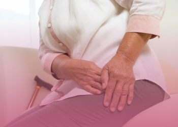 Artrose de quadril: 5 maneiras de prevenir a doença