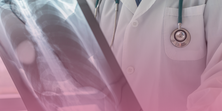 Em reunião da ANS, é aprovada a realização de audiência e abertura de consulta pública sobre tratamentos para câncer de pulmão, leucemia e linfoma, e consulta pública para atualização da DUT de asma