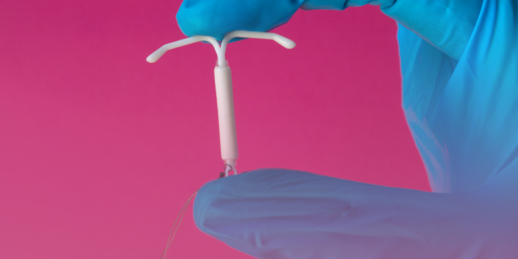 DIU aumenta risco de câncer de mama? Novo estudo indica quando o método contraceptivo pode representar ameaça