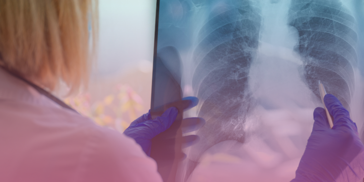 Análises da 33ª reunião técnica da Cosaúde