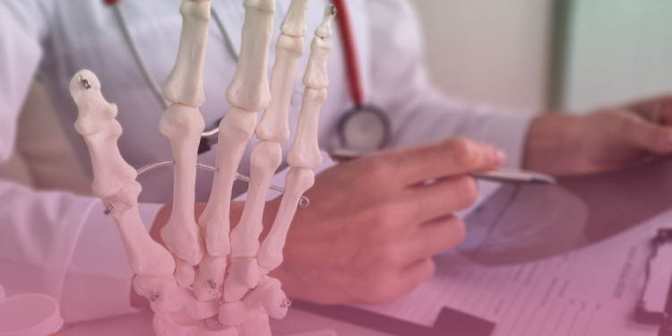 Novos tratamentos e perspectivas de medicina de precisão para pacientes de artrite reumatoide