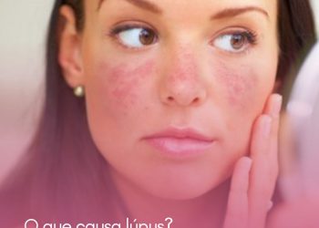 Olho seco pode ser doença de Sjögren