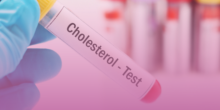 A partir de que idade crianças e adolescentes devem dosar o colesterol?