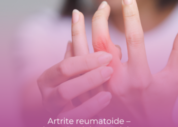Artrite reumatoide – alterações laboratoriais e prognóstico.