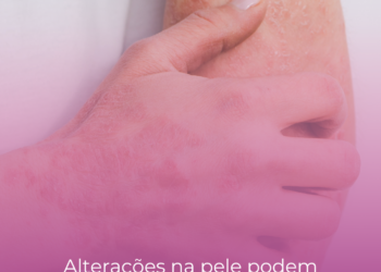 Alterações na pele podem indicar doença reumática