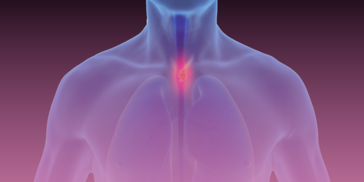 Otorrinolaringologista alerta sobre causas e tratamentos da disfagia