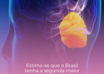 Estima-se que o Brasil tenha a segunda maior prevalência de Ataxia de Friedreich no mundo