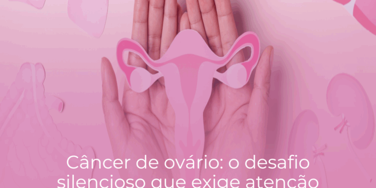Câncer de ovário: o desafio silencioso que exige atenção redobrada das mulheres, especialmente após a menopausa.