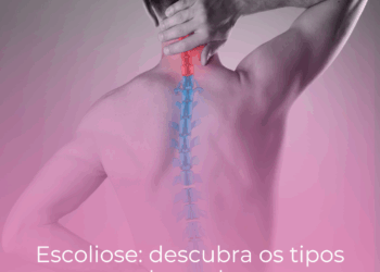 Escoliose: descubra os tipos e causas dessa doença que afeta a coluna
