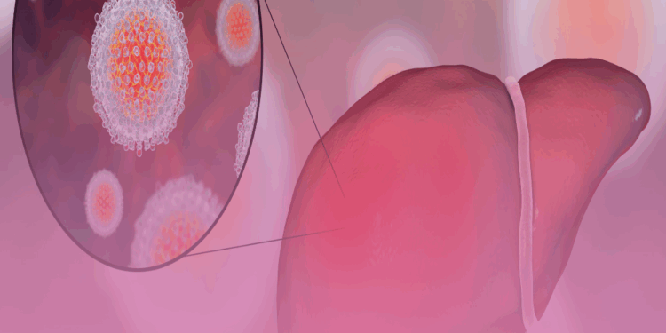 Hepatite viral: falta de diagnóstico é o principal empecilho para erradicá-la