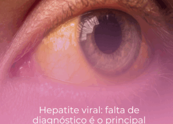 Hepatite viral: falta de diagnóstico é o principal empecilho para erradicá-la