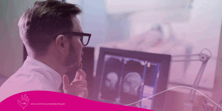 IA descobre que remédio para artrite pode tratar doença rara.