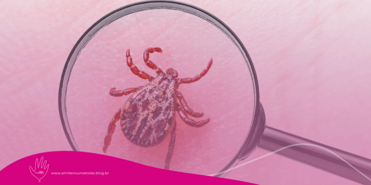 Doença de Lyme: entenda o que é, sintomas e tratamento