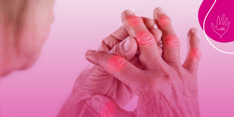 Artrite: confira cinco partes do corpo que podem ser afetadas pela doença e sofrer graves problemas