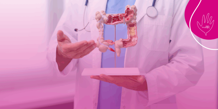 A ANS abre a Consulta Pública nº 162 sobre incorporação de novos medicamentos para retocolite ulcerativa nos planos de saúde