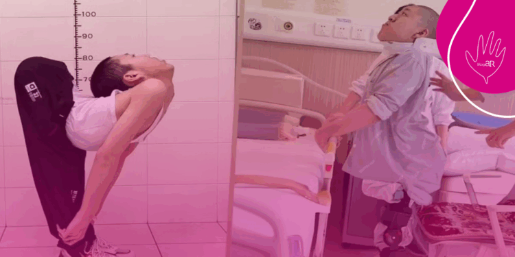 Após cirurgias na coluna, jovem chinês consegue ficar em pé e deitar pela 1ª vez