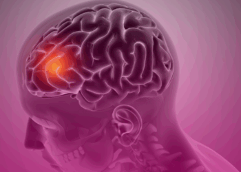 AVC é a segunda principal causa de morte no Brasil