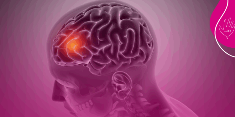 AVC é a segunda principal causa de morte no Brasil