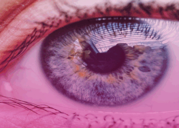 Oftalmologistas promovem campanha para prevenir a retinopatia diabética, doença que pode causar a cegueira