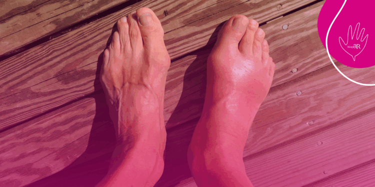 Dores reumáticas podem gerar incapacidade profissional