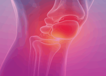 Artrose: por que César Filho precisou de mais uma cirurgia e como evitar a doença