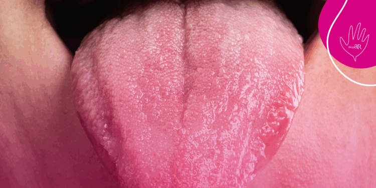 Confira o Biored Explica: Doença de Sjögren, enfermidade autoimune rara pode afetar também os pulmões